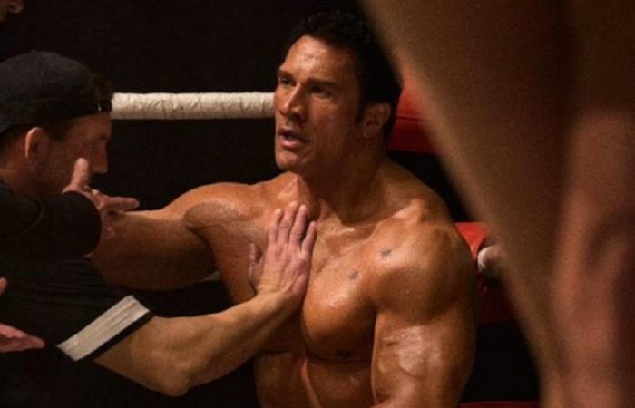 Dwayne „The Rock“ Johnson zeigt seine schreckliche Ellenbogenverletzung während der Dreharbeiten zu „The Smashing Machine“