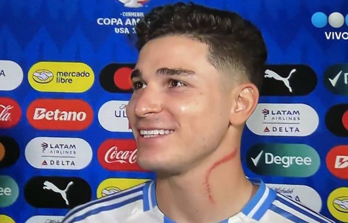 Was geschah mit dem Hals von Julián Álvarez beim Sieg der argentinischen Nationalmannschaft gegen Kanada bei der Copa América 2024?