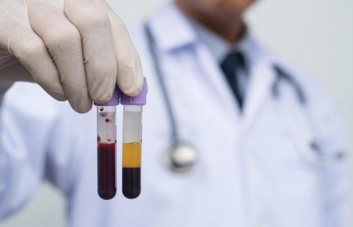 Blutkrankheiten stehen im Vordergrund der personalisierten Medizin und erzielen Rekordüberlebensraten