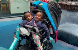 Die schockierende Geschichte der siamesischen Zwillinge Marieme und Ndeye: Sie sagten, sie würden nicht überleben und wollten sie trennen, aber ihr Vater weigerte sich